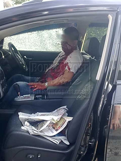 GUNSHOT WOUNDS : Lim bleeding from his wounds sitting in his vehicle before the ambulance arrived.