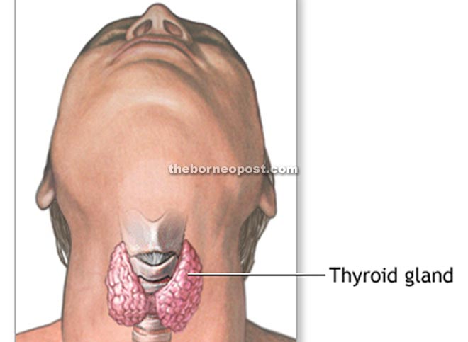 The thyroid gland is a butterfly-shaped endocrine gland in the neck, which releases the hormones instrumental in regulating one’s body metabolism.