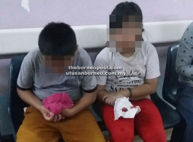 Lesson learnt as the two siblings await treatment at SGH after their explosive misadventure playing with fireworks.