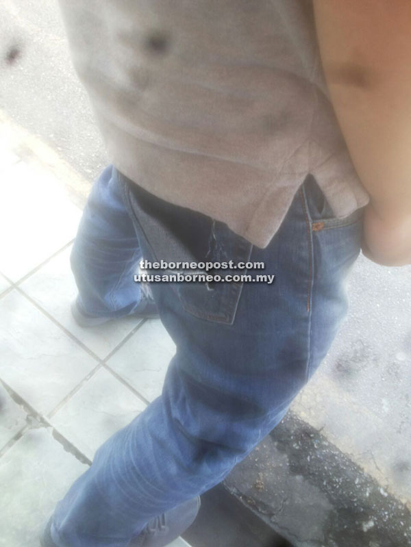 Photo shows the victim’s torn back pocket.