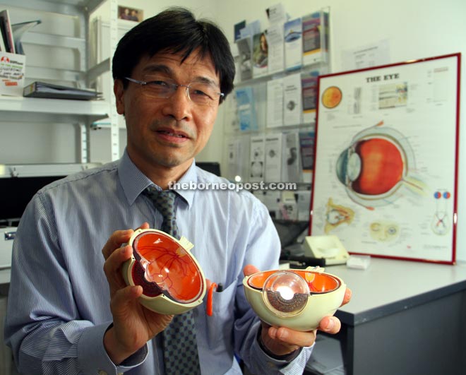 Dr Kong shows the inside of an eyeball anatomy model. — Photo by Chimon Upon