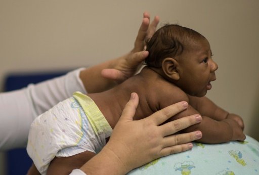 Microcephaly is a rare neurological disorder that causes a baby's head to be smaller than normal and prevents its brain from fully developing -AFP photo