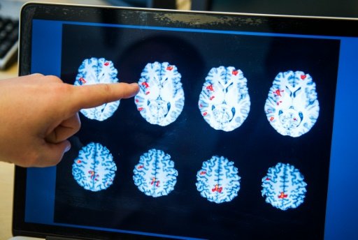 Scientists can now predict whether someone will lie by looking at brain scans by Marlowe Hood | -AFP photo